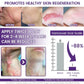 TIMILK Scarvanisher Scar Gel 30g | Advanced Scar & Stretch Marks Removal Cream | Fast-Absorbing Skin Repair Gel