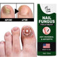 Fast Nail Fungus Treatment Serum | Nail Repair Essence for Fingernails & Toenails | Natural Nail Care Formula
