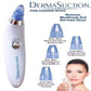 Blackhead Removal Machine | Derma Suction 3 In 1 Black Head Remover Machine | Acne Pimple Pore Cleaner Vacuum Suction Tool