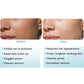 Pilgrim Peeling Solution | Weekend Facial Peel for Deep Cleansing & Exfoliation | Radiant & Even-Toned Skin | For Men & Women | 30ml